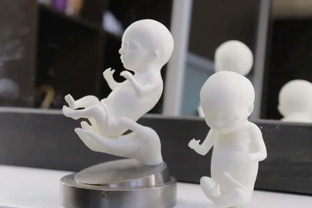 Embryo 3D