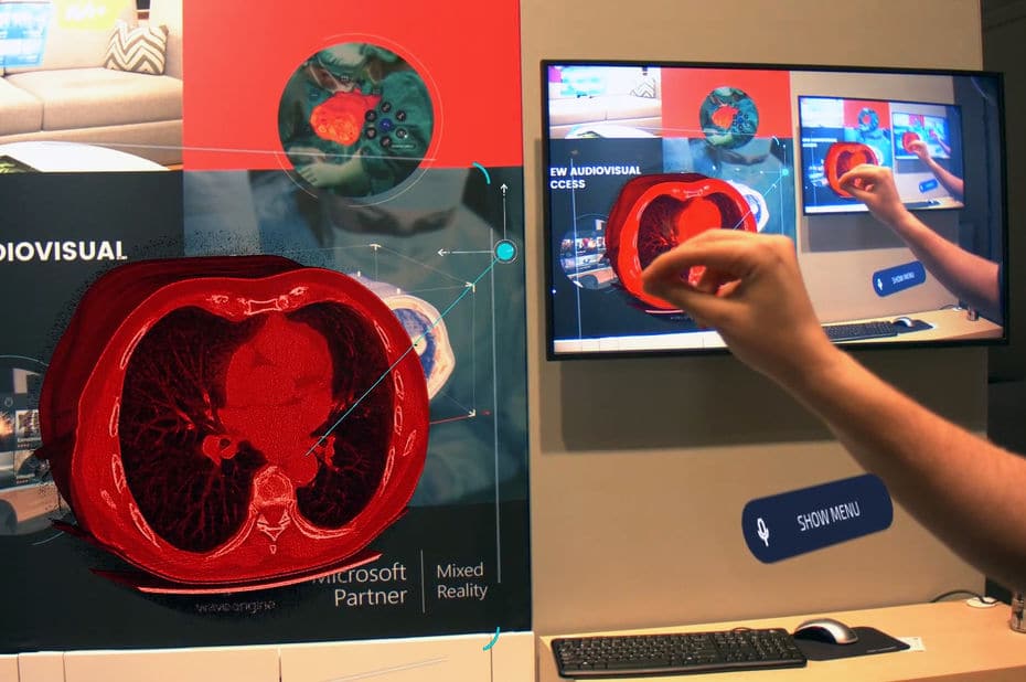 Biopsies HoloLens réalité augmentée