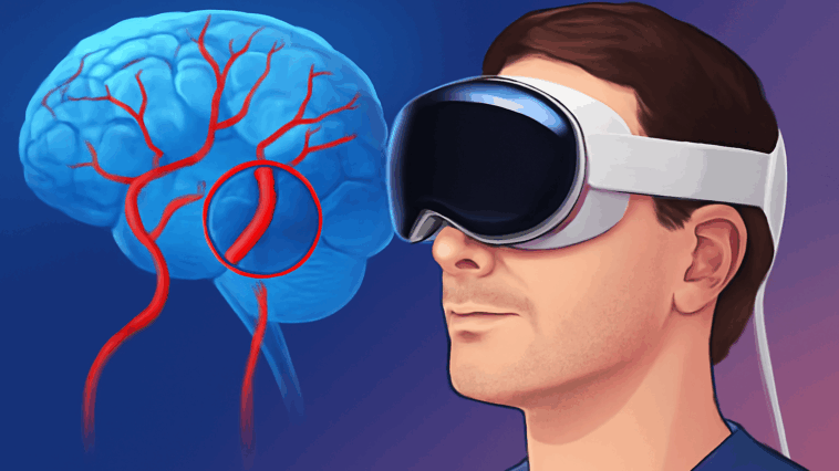 Un implant cérébral pour contrôler l'Apple Vision Pro bientôt disponible ?
